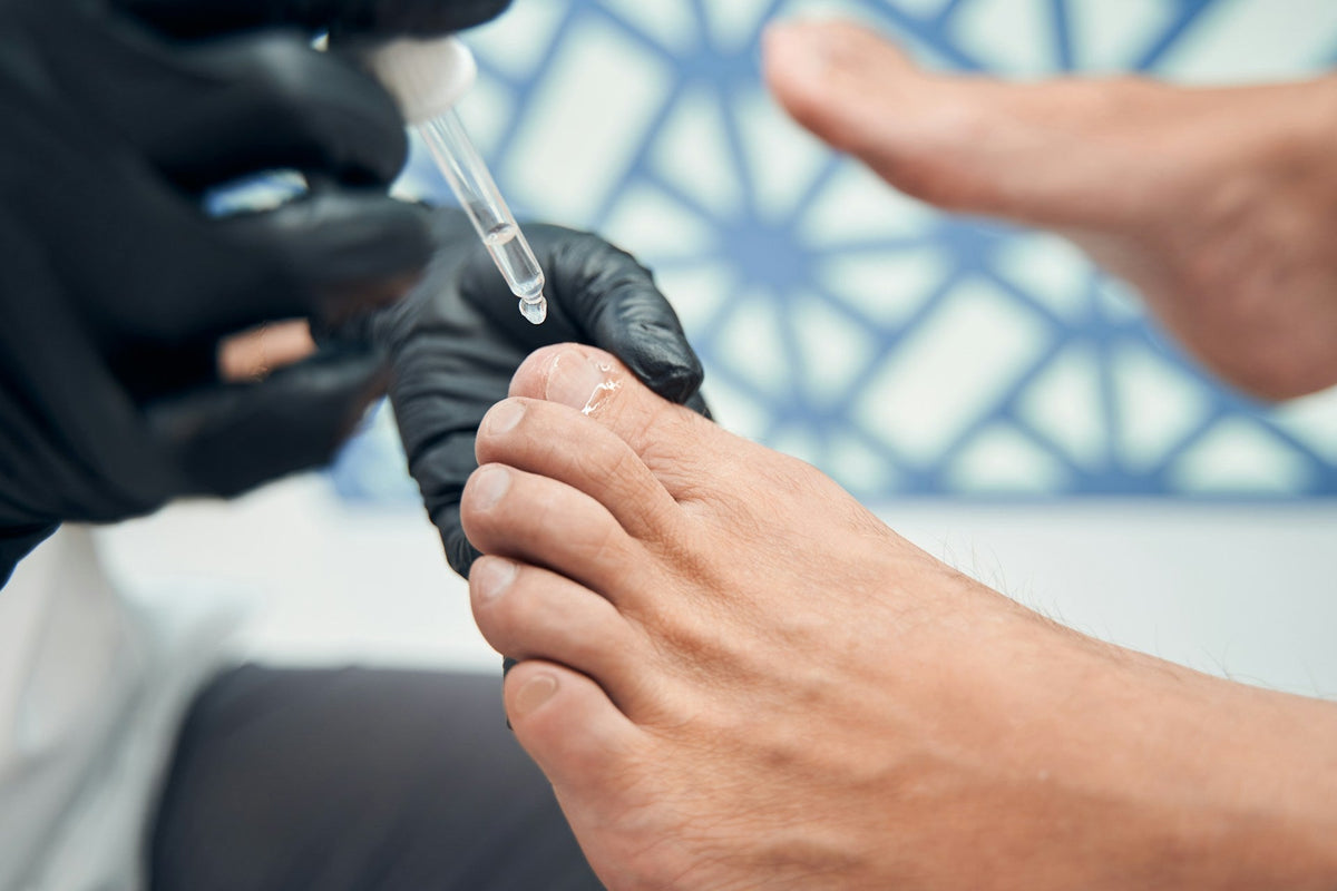 6 Reasons Your Toenails Are Turning Yellow (It's Not Always Fungus)