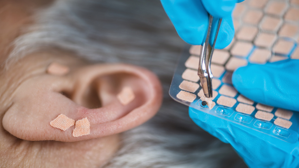 Is The Secret to Losing Weight Hiding in Your Ears?